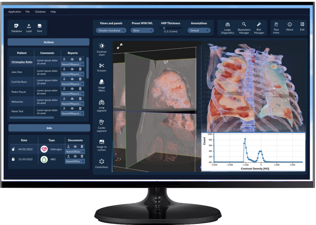 weresp_web_ventilation-1